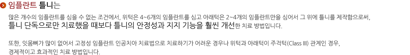 임플란트 틀니