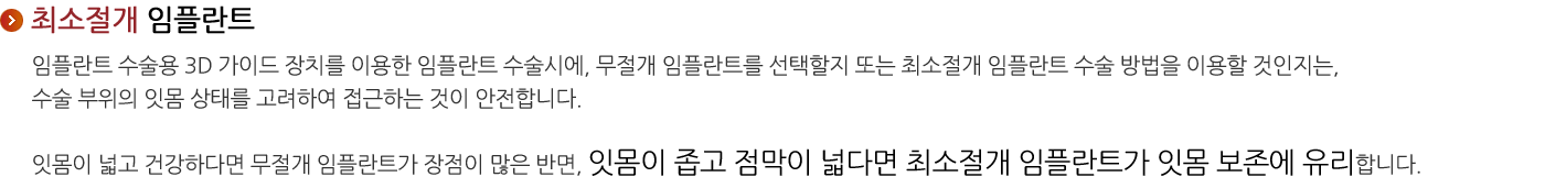 최소절개 임플란트
