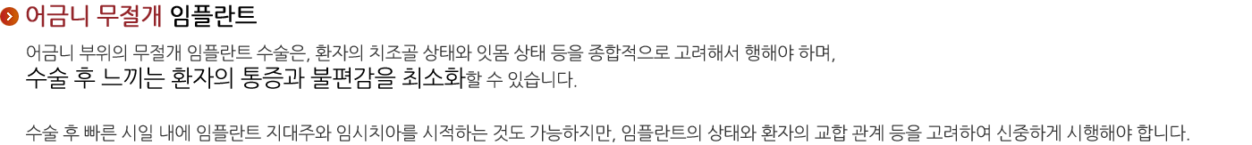 어금니 무절개 임플란트
