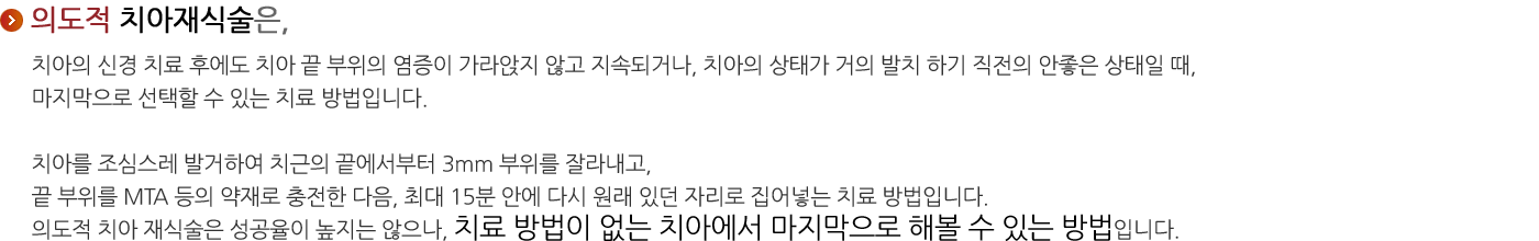 의도적 치아 재식술